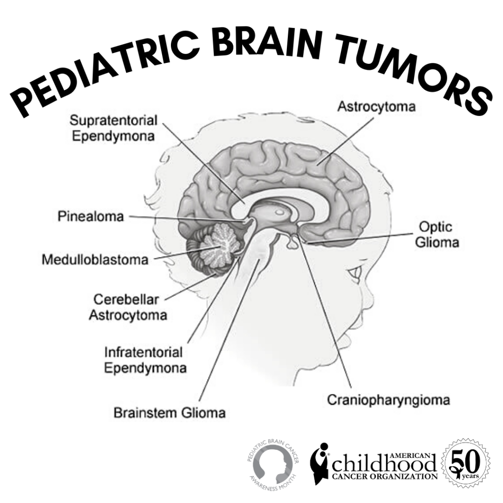 Brain Tumor Awareness Month Acco 1702